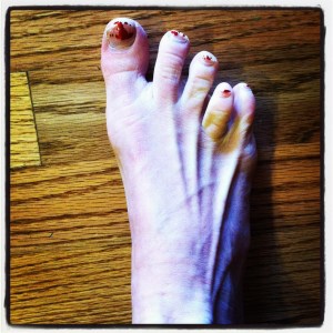 I have ugly feet and am in dire need of a pedicure.